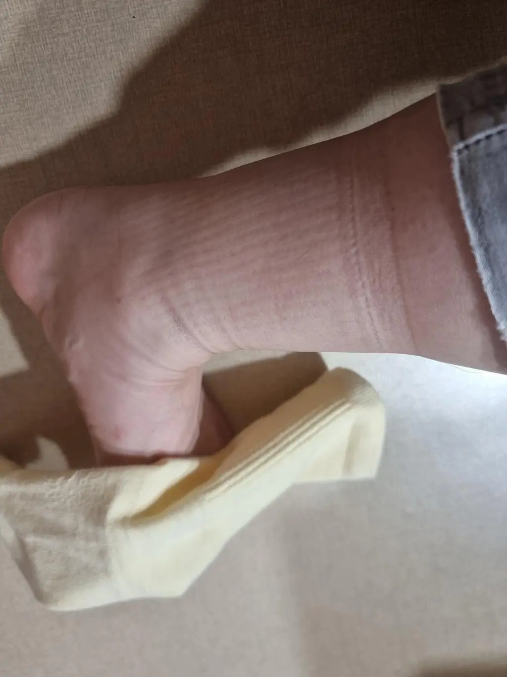 족저근막염과 지간신경종이 있어서 리뷰보고 잔뜩 구매했는데 기대가 너무 컸었던건지 