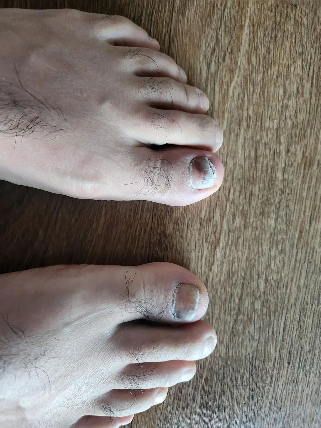 발목 잡아주고 쿠션은 좋은데 슬립이 있네요
