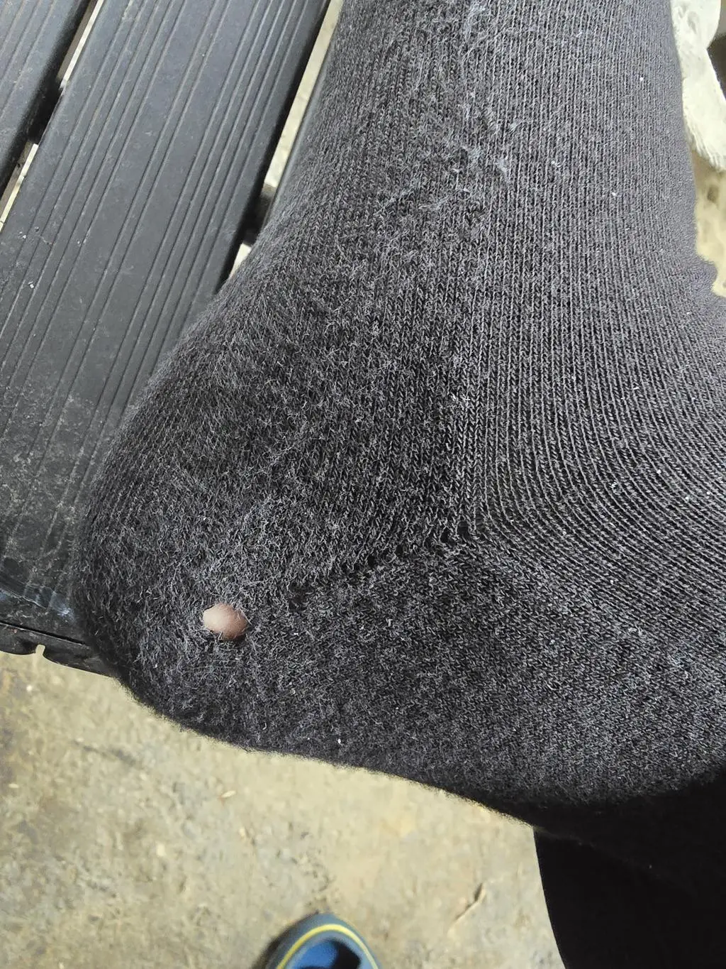 양말 너무 좋았어요. 그런데 검정색 하나가 구멍이 나 있어요 어떻게 해야 하나요