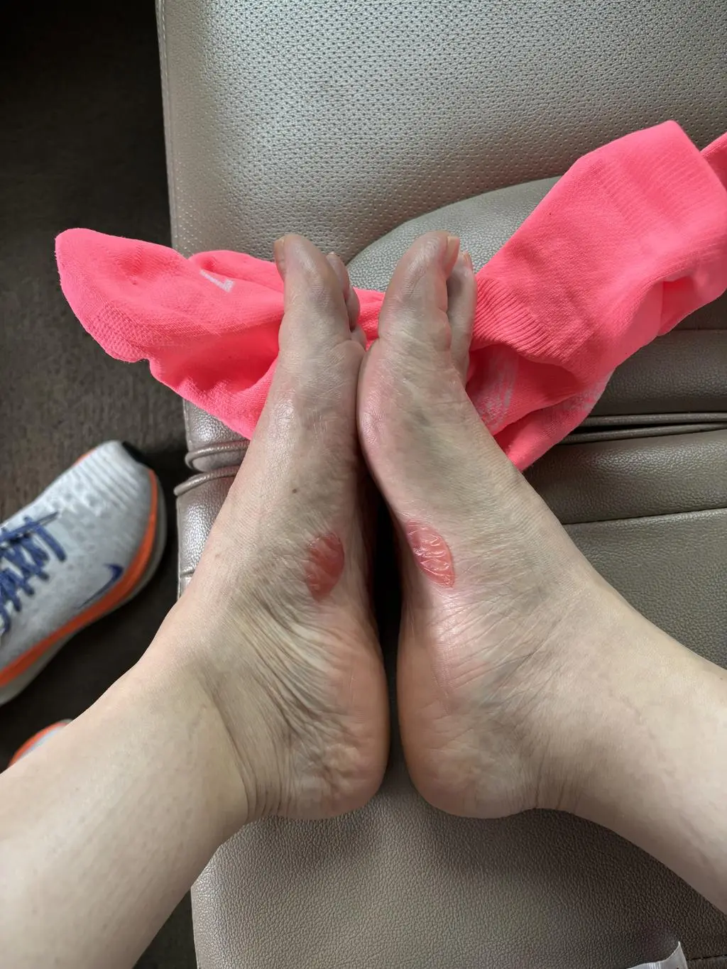 오늘 경주 벚꽃마라톤 10키로 뛰었는데 물집잡힌거에요 ㅠㅠ 아파죽는줄 ㅠㅠ  양말 자