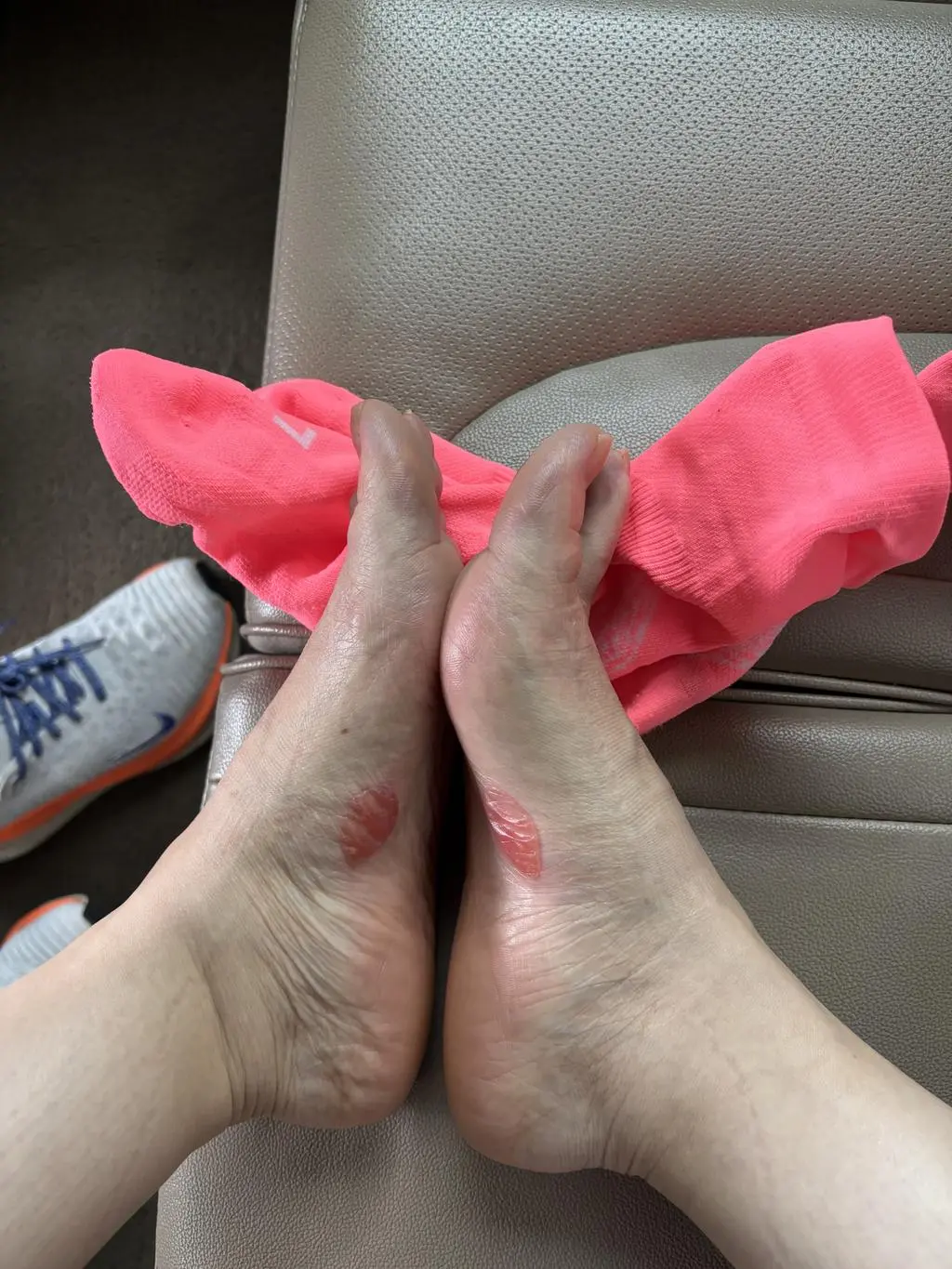 오늘 경주 벚꽃마라톤 10키로 뛰었는데 물집잡힌거에요 ㅠㅠ 아파죽는줄 ㅠㅠ  양말 자