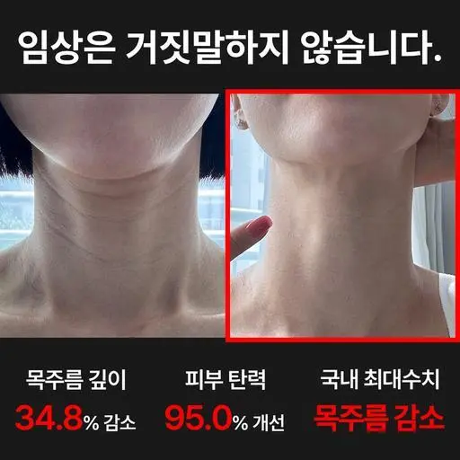 🔥2시간 뒤 가격 상승🔥 임상입증 목주름 -34.8% 콜라겐 목주름팩 비밀특가