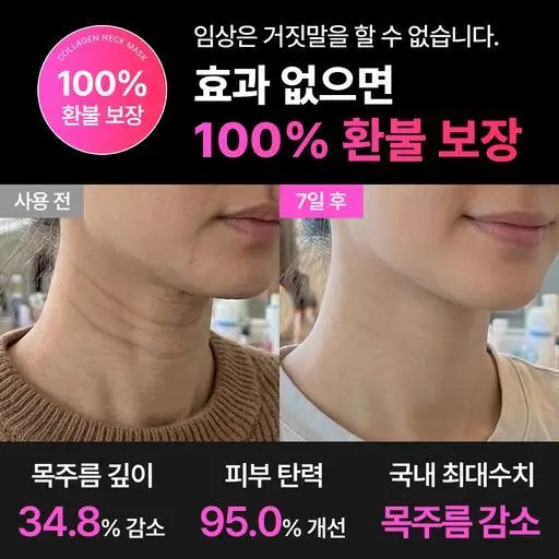 [선착순 200명만] 임상입증 콜라겐 엑소좀 목주름팩 비밀특가🔥