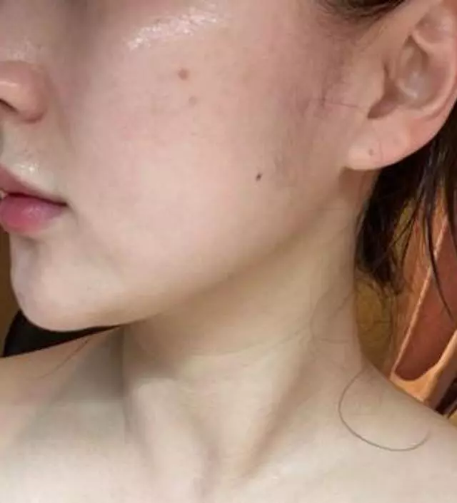 바이오던스 아로셀 메디엔서 바이에콤 토리든 그리고 ckd까지왠만한 겔팩다써본사람입니