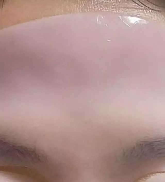 피부결이 즣아지네요. 일시적이지만 잔주름도 좋아집니다
