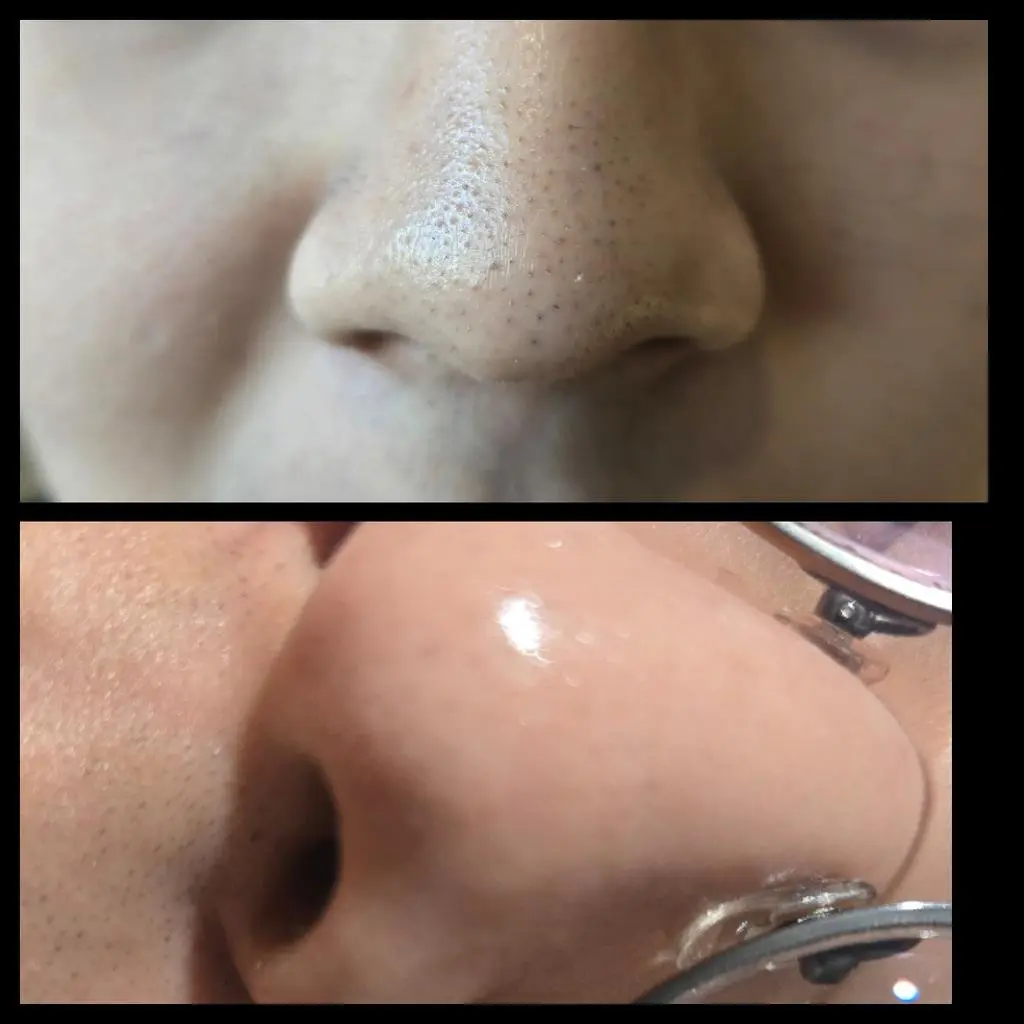 솔직히 안 믿었어요
