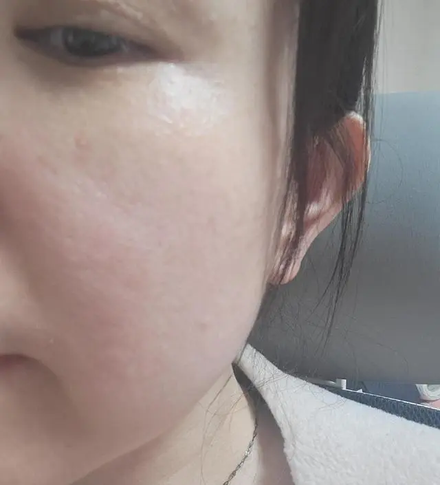 요즘 기미가 엄청 올라와서 고민인데 한번 하고 오잉? 환해진 느낌?
