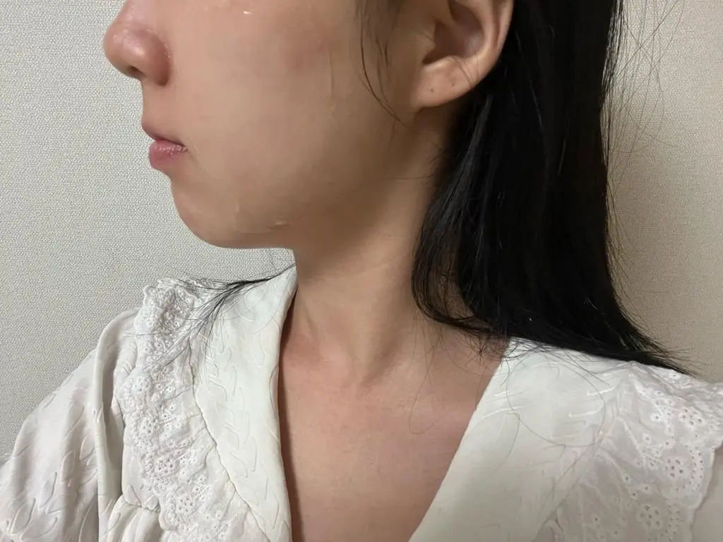 받자마자 주의사항만 읽고 사용했는데 효과가 눈에 보여서 너무 깜놀..꾸준히 더 하면 