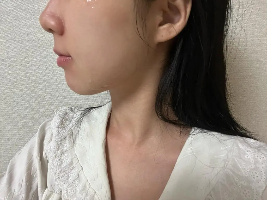 받자마자 주의사항만 읽고 사용했는데 효과가 눈에 보여서 너무 깜놀..꾸준히 더 하면 