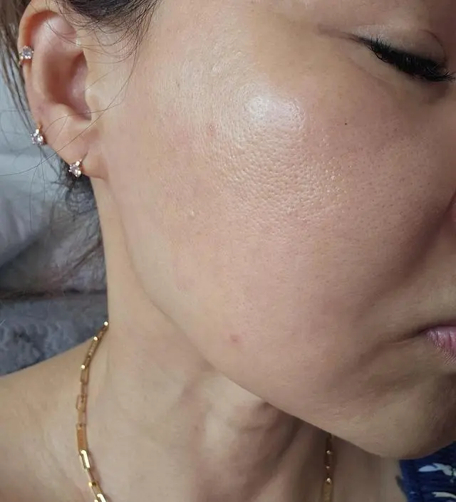 아침에 일어나서 보니 얼굴이 리프팅 되여있는 것같아요~
