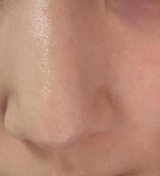 촉촉하고 너무 좋습니다. 쿨링도 되고 수분공급도 되고 붙인채로 자도 되어서 너무 좋습