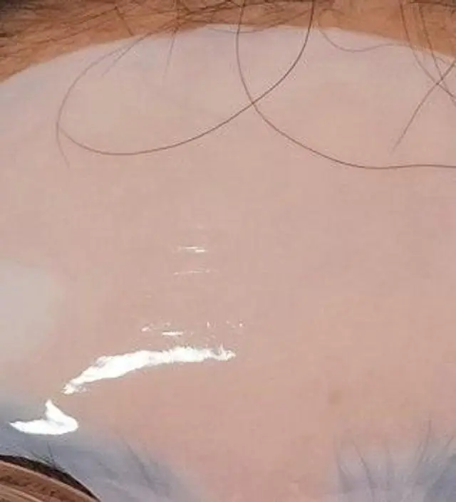 피부가 거칠어 졌을때 붙이면 효과만점
