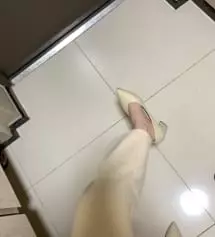 저...전에 없던 고츄가 생겼어요 불로 지지면 해결될까요..? 블랙 샀을땐 이런일 없었는