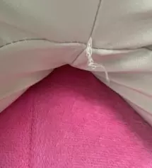 저...전에 없던 고츄가 생겼어요 불로 지지면 해결될까요..? 블랙 샀을땐 이런일 없었는