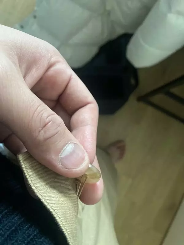 단추가 다 떨어지려고하네요 ㅋㅋ 풀려서 어떻게입죠..