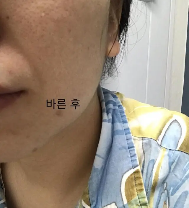 갈락토미 나이아신 에센스 50ml
