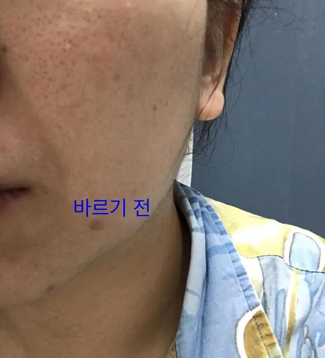 갈락토미 나이아신 에센스 50ml
