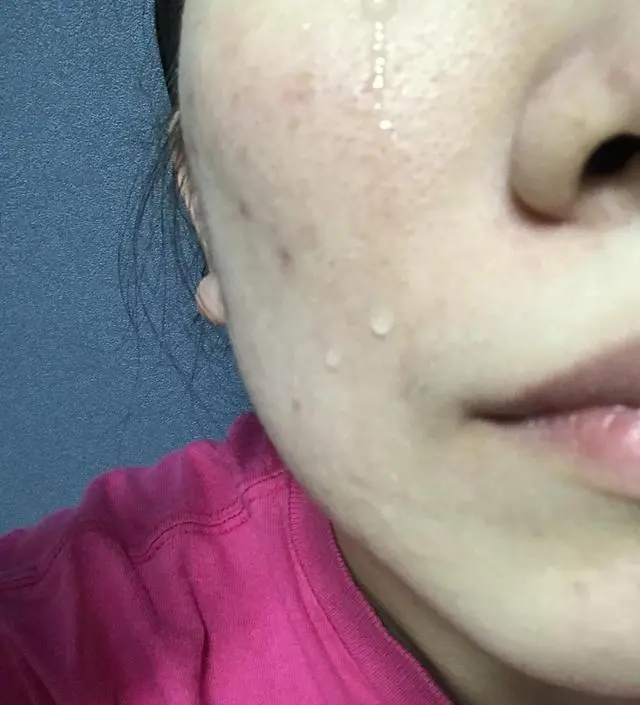 갈락토미 나이아신 에센스 50ml
