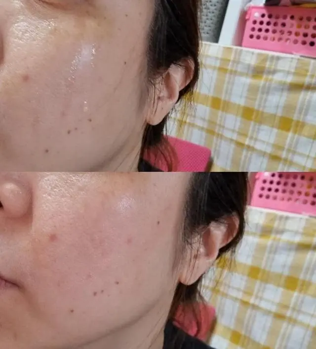 갈락토미 나이아신 에센스 50ml
