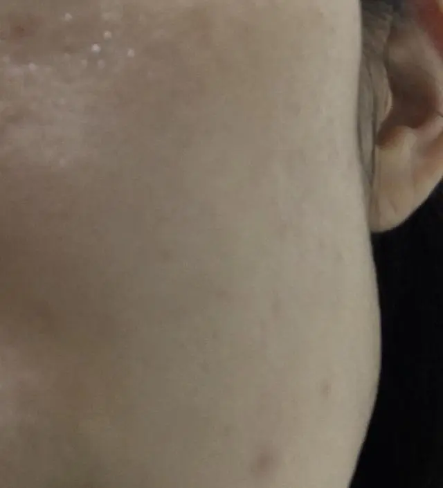 갈락토미 나이아신 에센스 (+증정)
