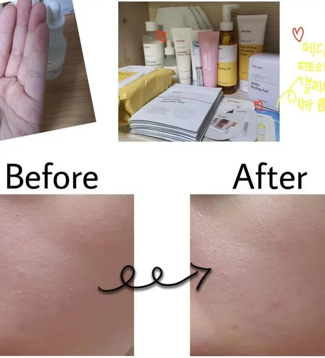 갈락토미 나이아신 에센스 50ml
