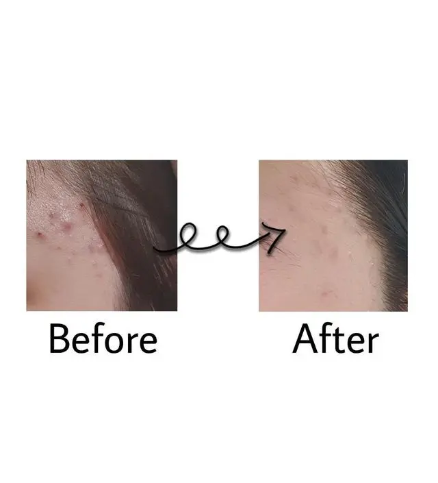 갈락토미 나이아신 에센스 50ml
