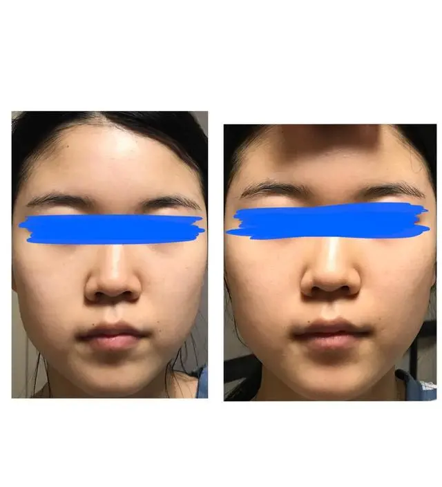 갈락토미 나이아신 에센스
