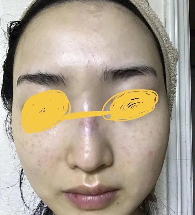 [모공 기초 케어] 갈락토미 나이아신 에센스 (+사은품)
