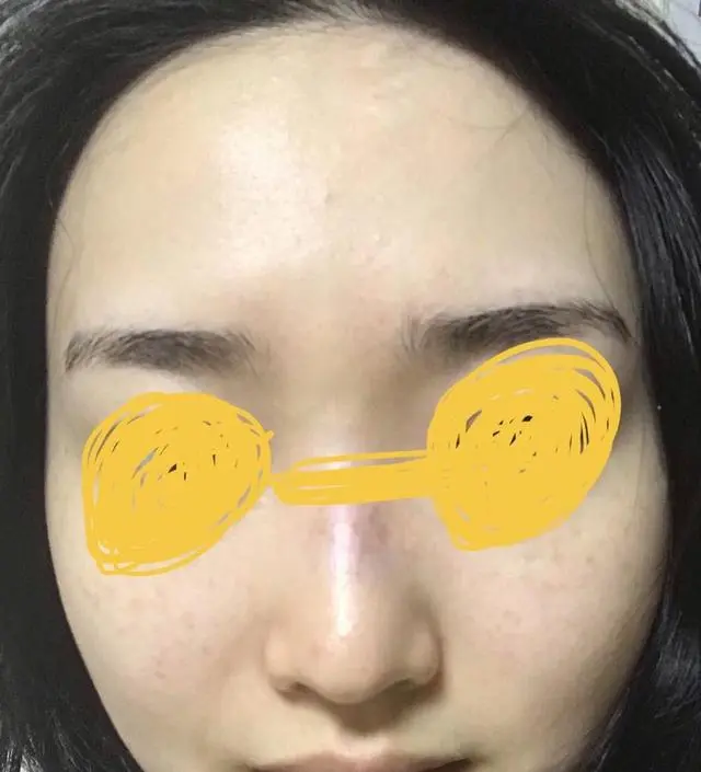 [모공 기초 케어] 갈락토미 나이아신 에센스 (+사은품)
