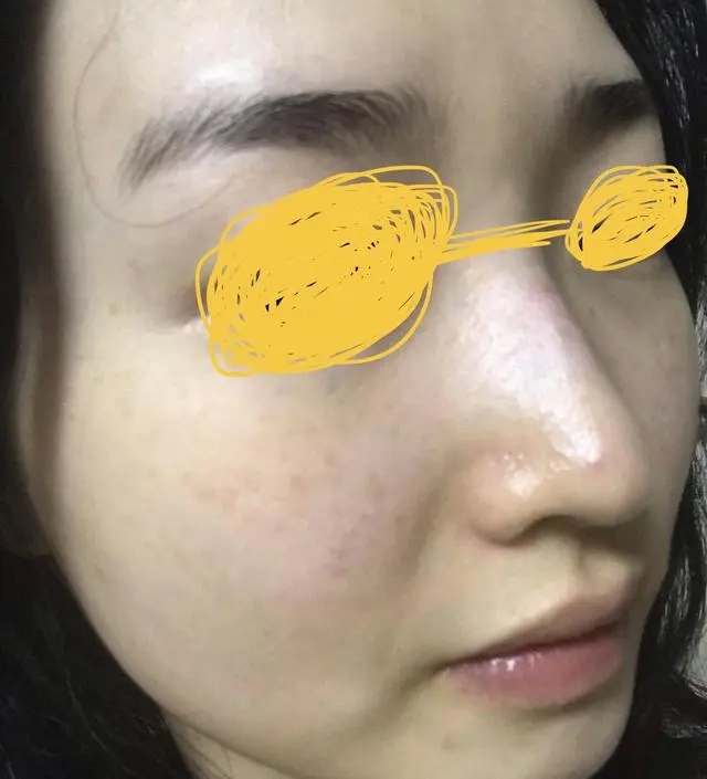 [모공 기초 케어] 갈락토미 나이아신 에센스 (+사은품)
