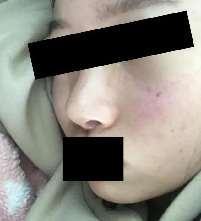 갈락토미 나이아신 에센스 50ml
