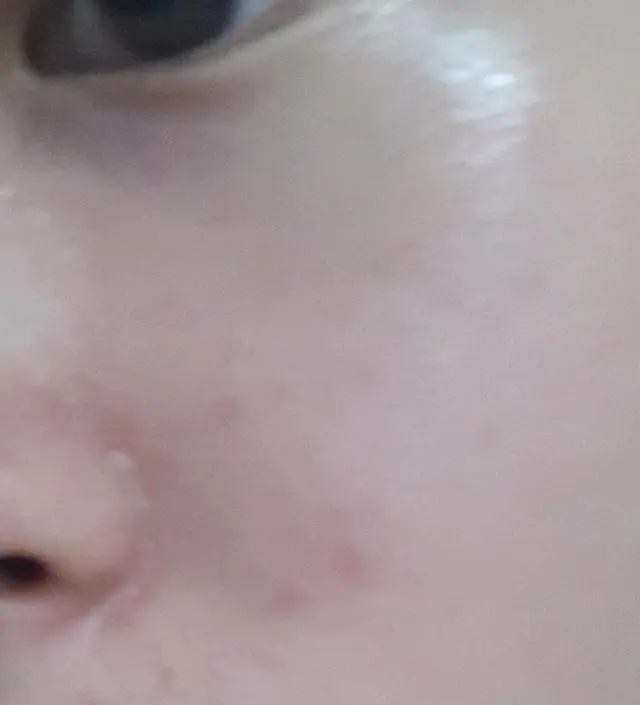 갈락토미 나이아신 에센스 50ml
