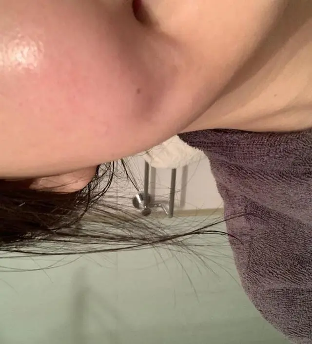 갈락토미 나이아신 에센스 50ml
