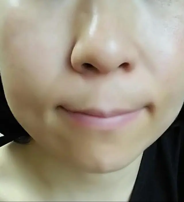 갈락토미 나이아신 에센스 50ml
