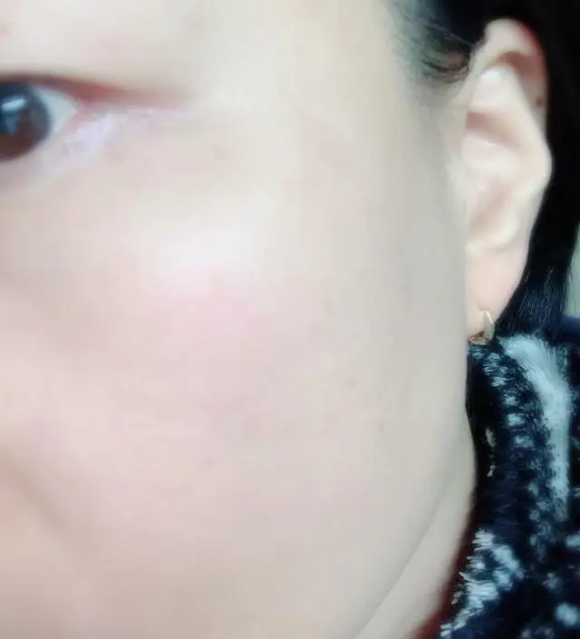 갈락토미 나이아신 에센스 50ml
