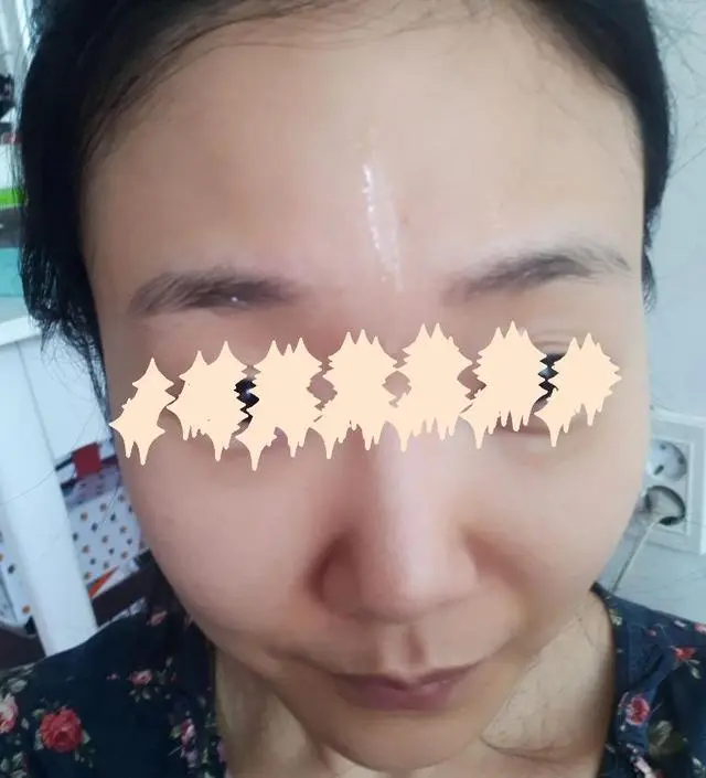 갈락토미 나이아신 에센스 50ml
