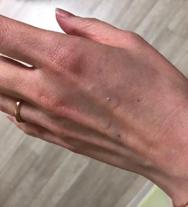 갈락토미 나이아신 에센스 50ml
