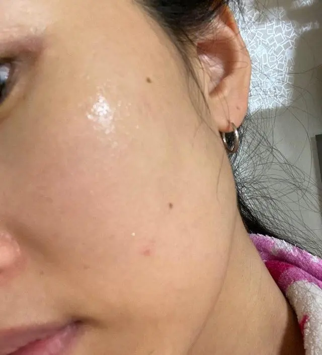 갈락토미 나이아신 에센스 50ml
