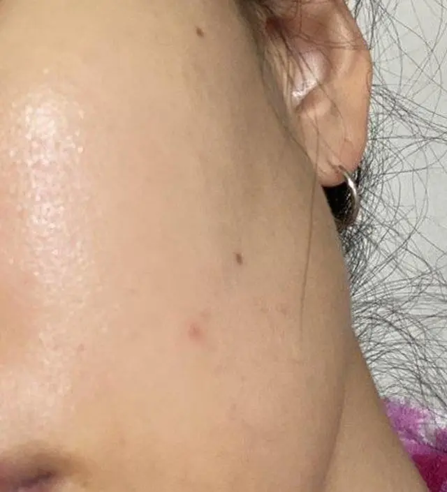 갈락토미 나이아신 에센스 50ml
