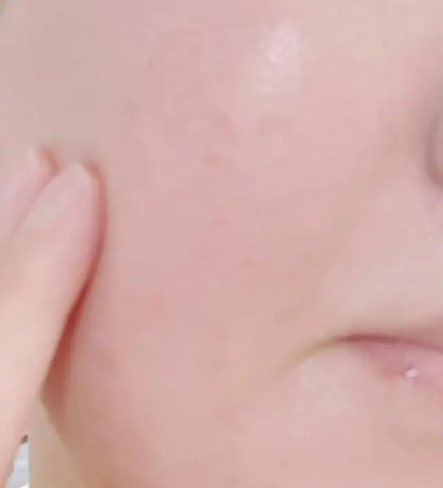 갈락토미 나이아신 에센스 50ml
