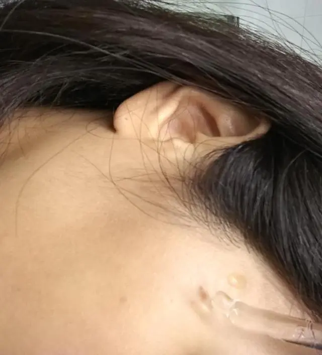 갈락토미 나이아신 에센스 50ml
