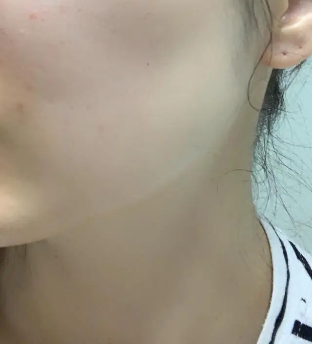 갈락토미 나이아신 에센스 50ml
