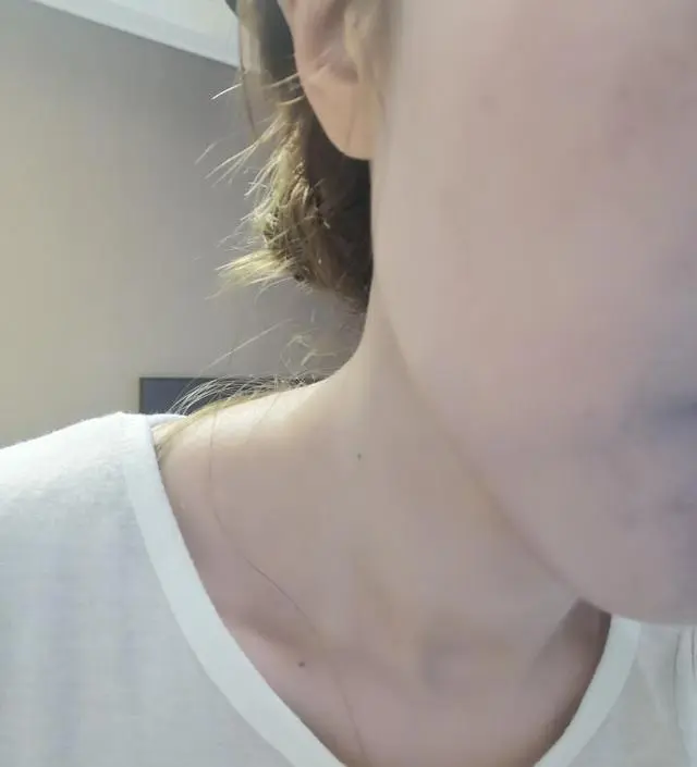 갈락토미 나이아신 에센스 50ml
