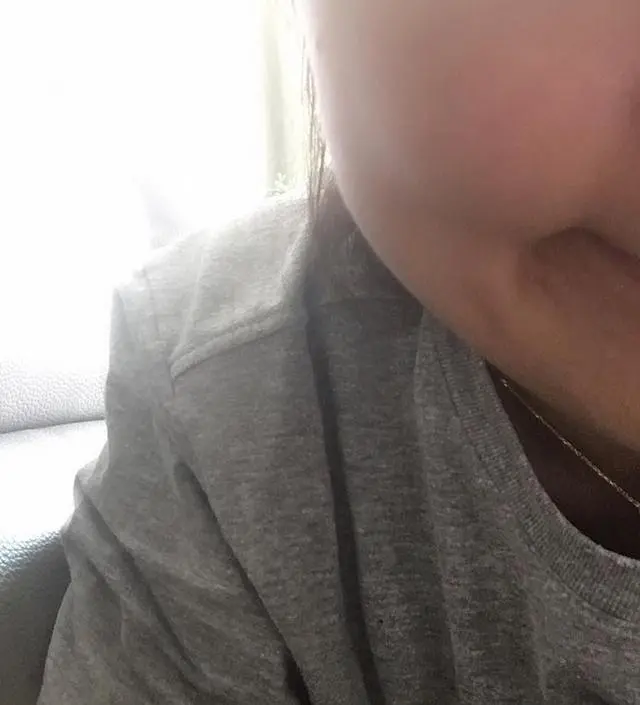 갈락토미 나이아신 에센스 50ml
