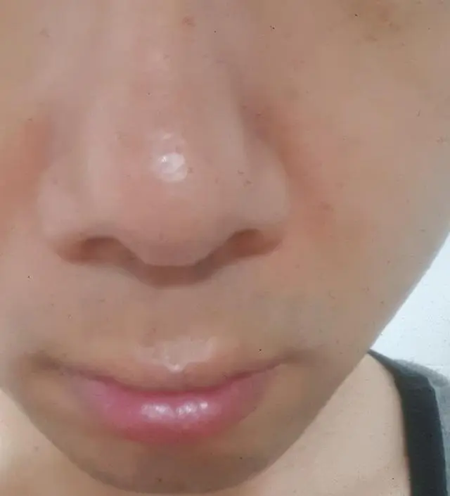 갈락토미 나이아신 에센스 50ml
