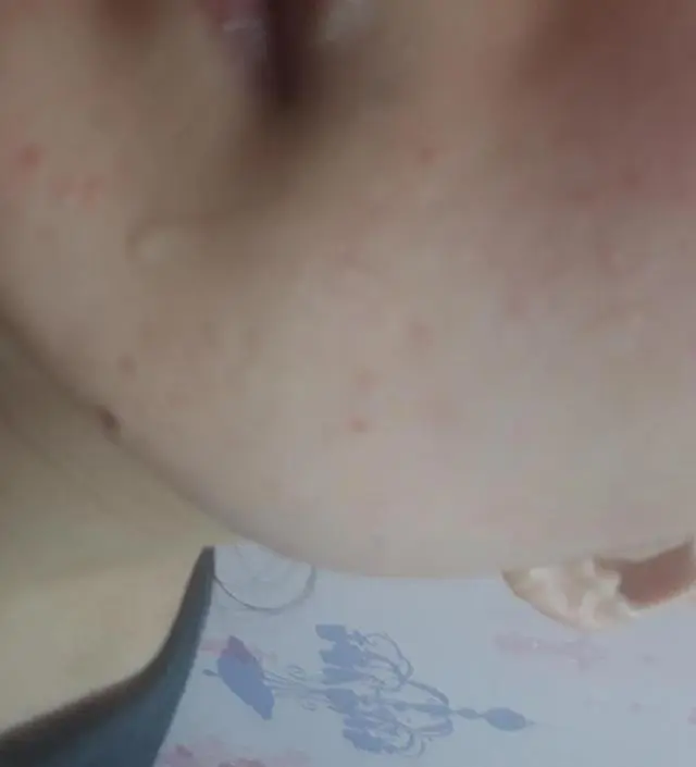 갈락토미 나이아신 에센스 50ml
