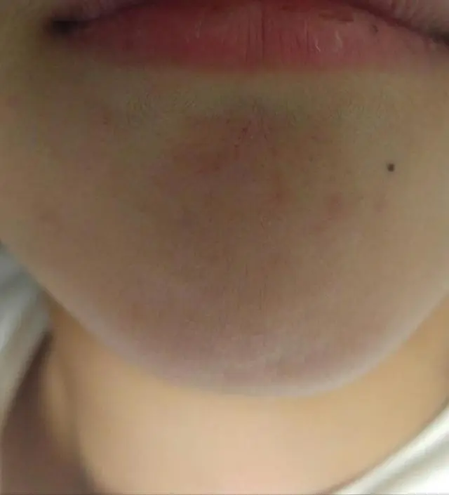 갈락토미 나이아신 에센스 50ml
