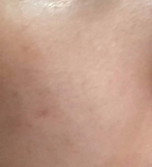 갈락토미 나이아신 에센스 50ml
