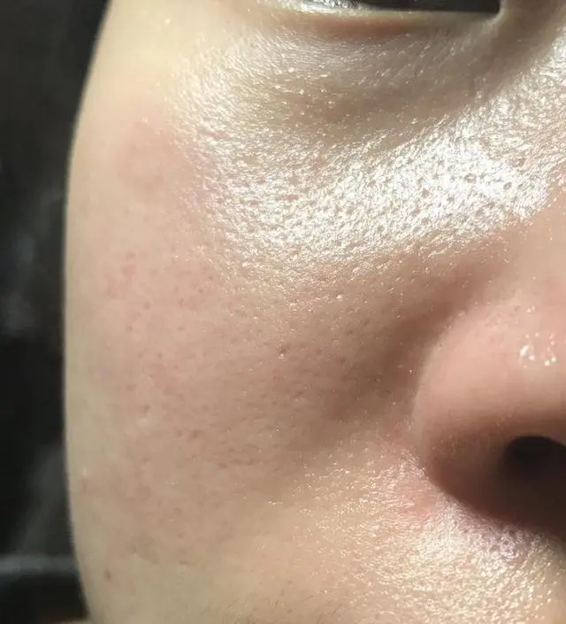 갈락토미 나이아신 에센스 50ml
