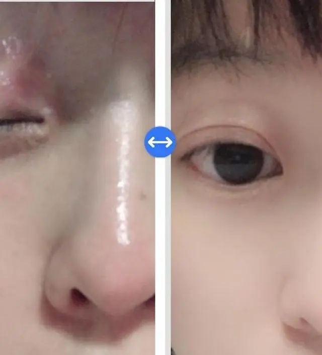 갈락토미 나이아신 에센스 50ml
